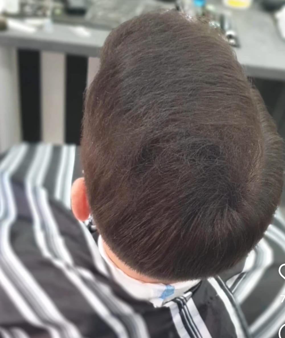 Customer photo review of Fibre copri Calvizie da 12gr  | Castano Scuro | 30 Giorni di applicazioni