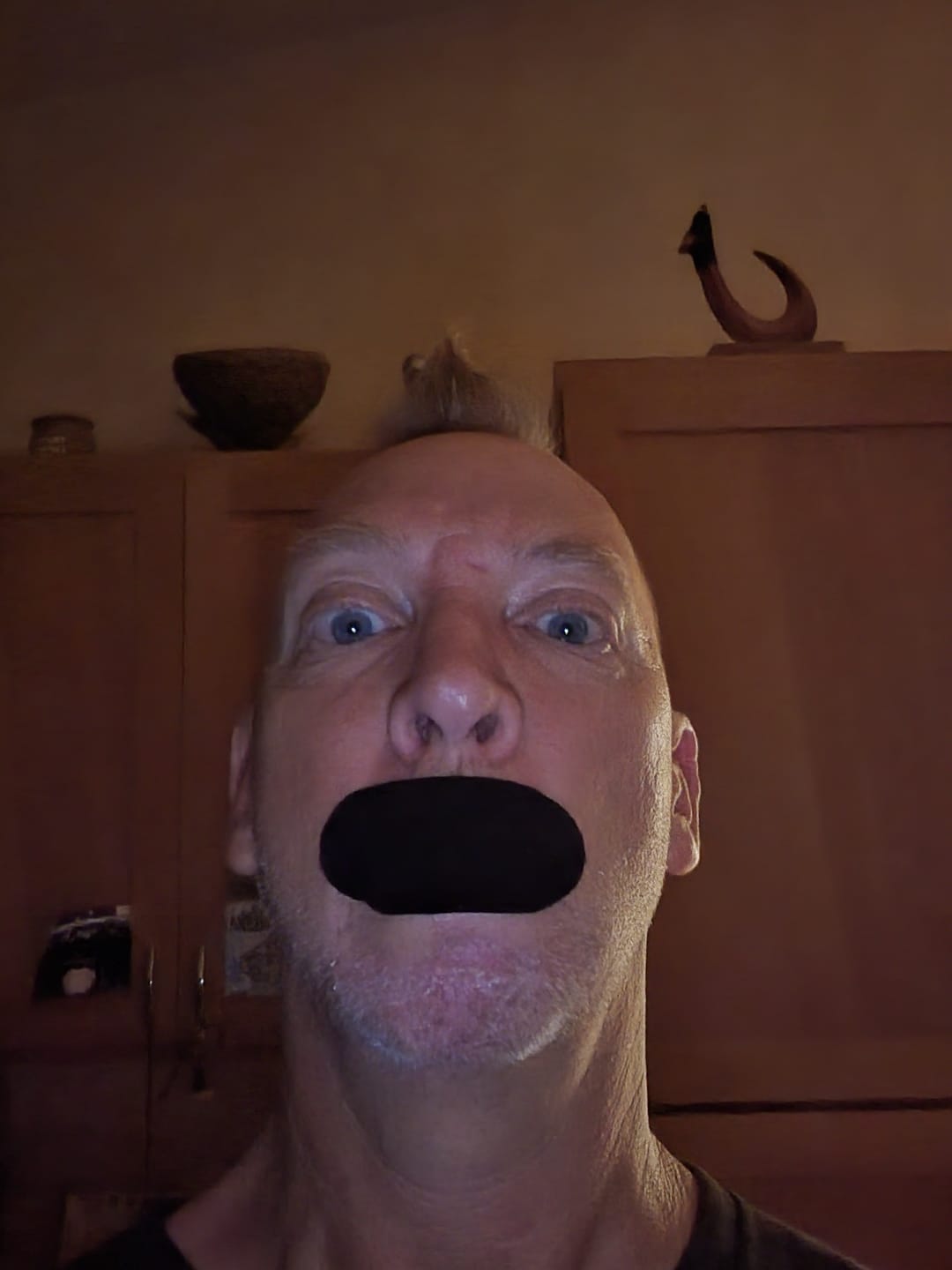 Customer photo review of 2 More Months Mouth Tape Special Offer