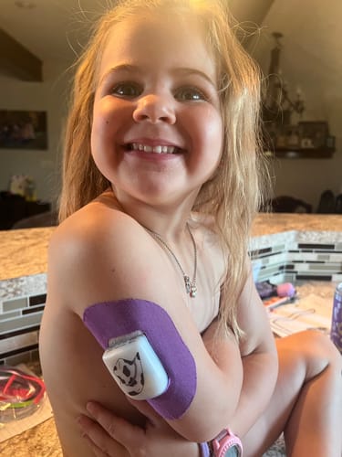 Customer photo review of Skin Grip Original - Omnipod Adhesive Patches