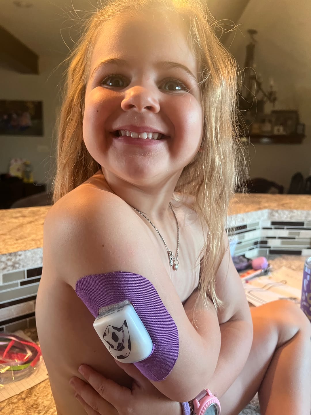 Customer photo review of Skin Grip Original - Omnipod Adhesive Patches