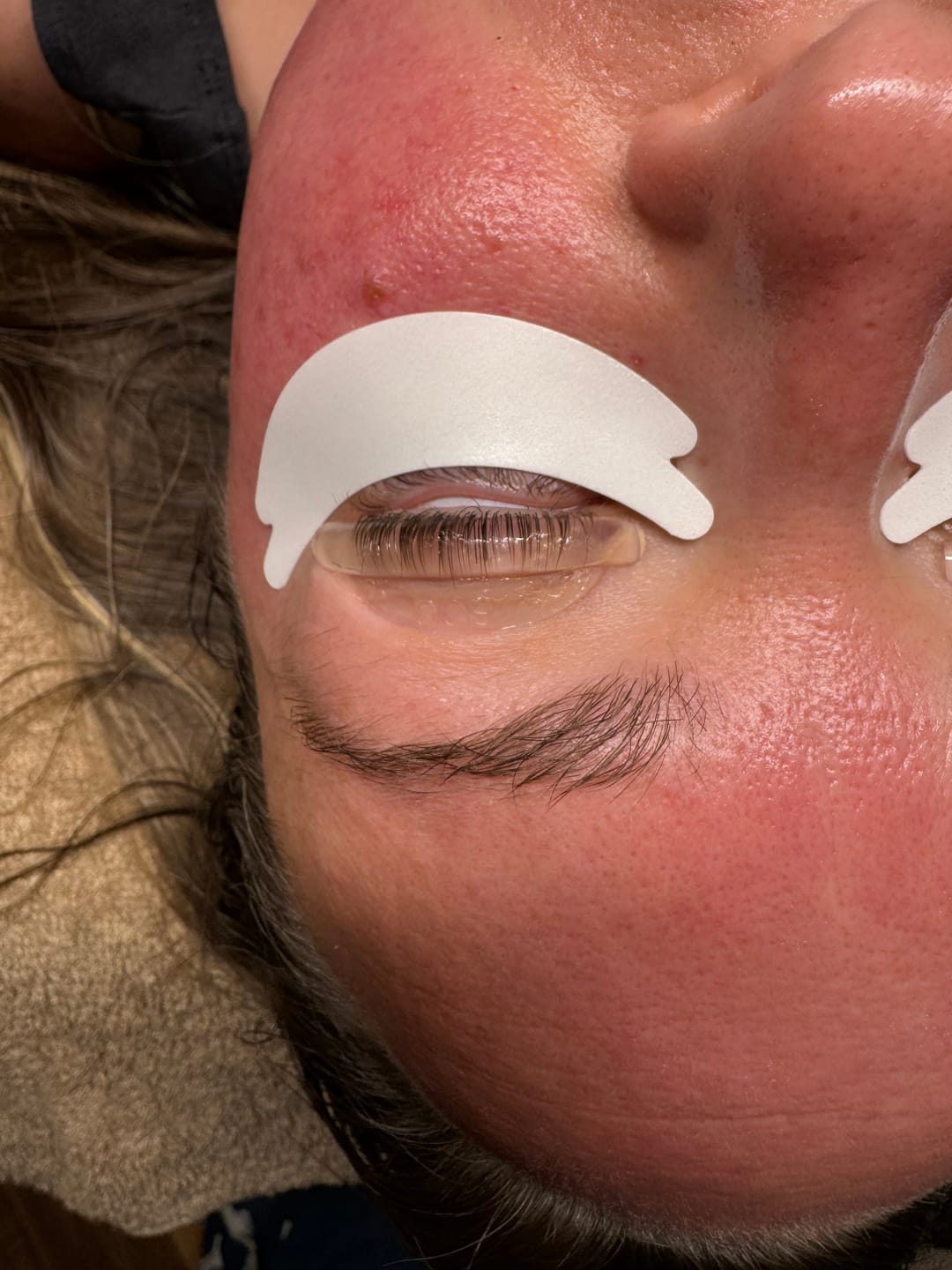 Customer photo review of Glue-Free Flexi Shields