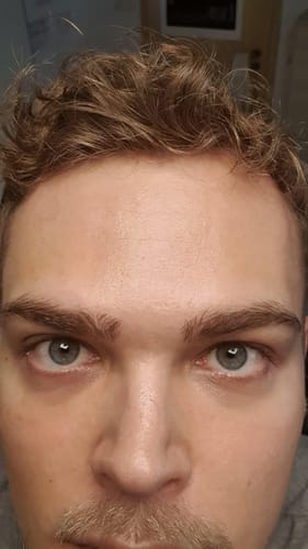 Customer photo review of Wrinkle Repair Tallow Balm - Sale