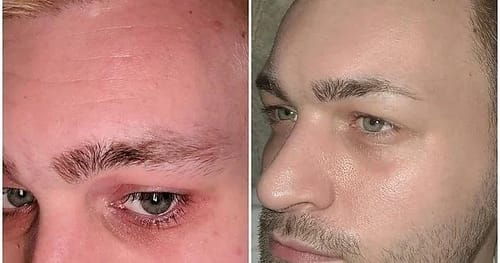 Customer photo review of Wrinkle Repair Tallow Balm - Sale