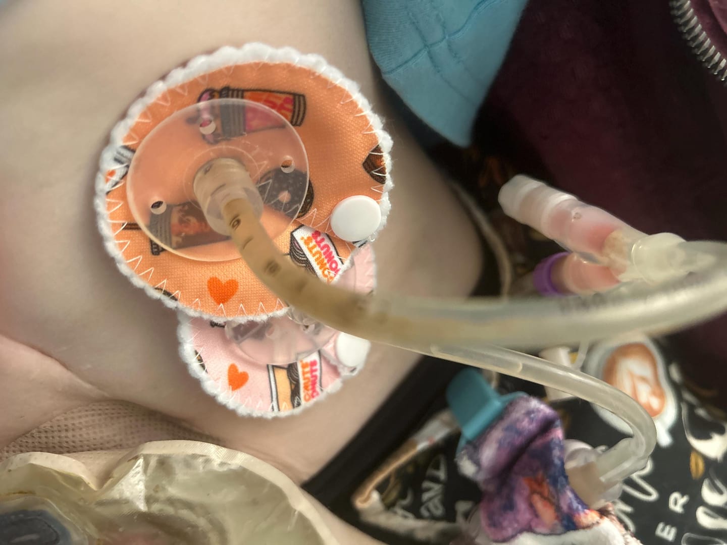 Customer photo review of Donuts & Coffee Feeding Tube Pads