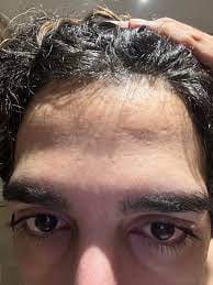 Customer photo review of Wrinkle Repair Tallow Balm - Sale