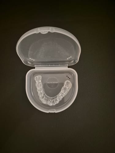 Customer photo review of SleepPro Slimline Night Guard 1.5mm