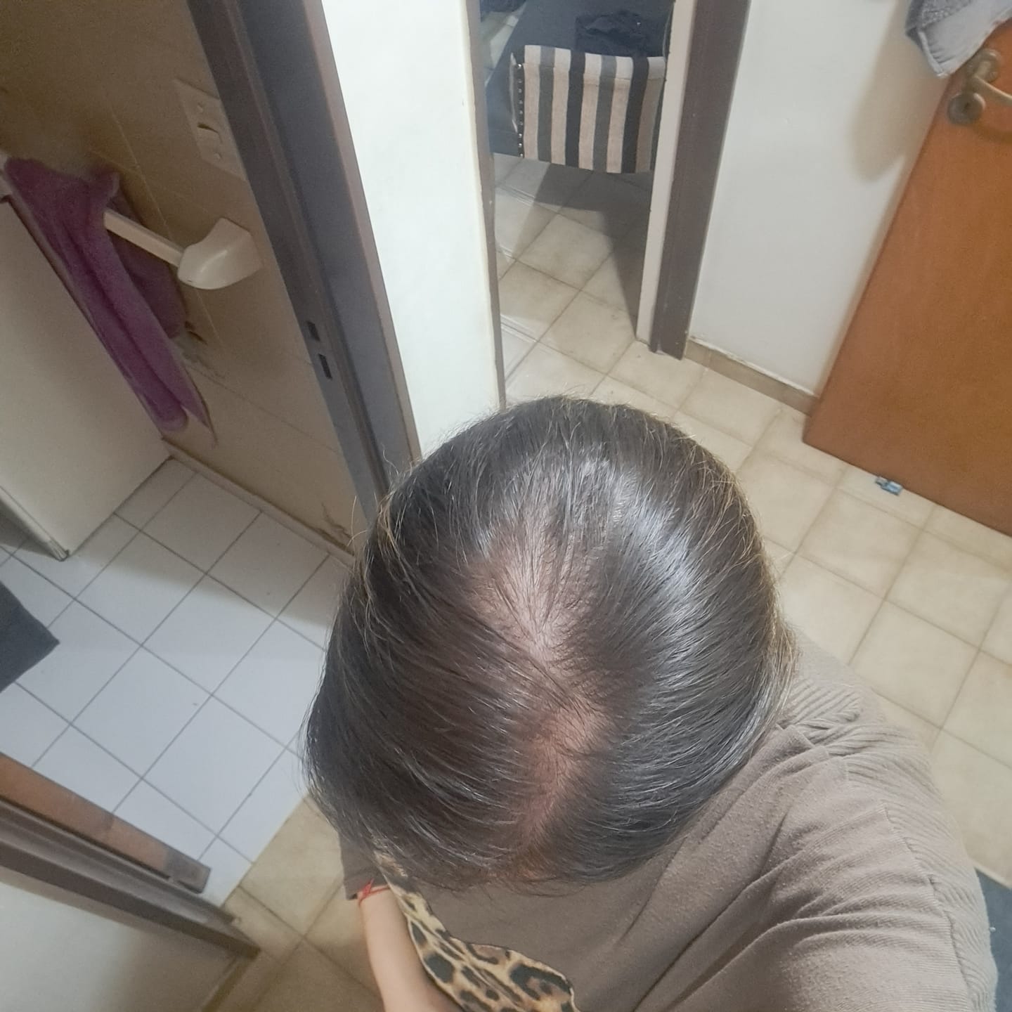 Customer photo review of Combo Anticaída - Shampoo, Acondicionador y Loción
