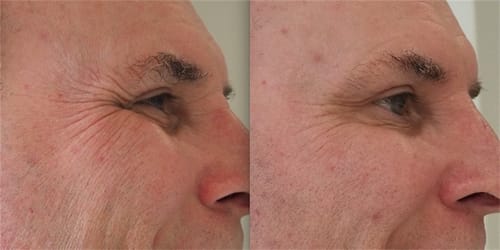 Customer photo review of Wrinkle Repair Tallow Balm - Sale