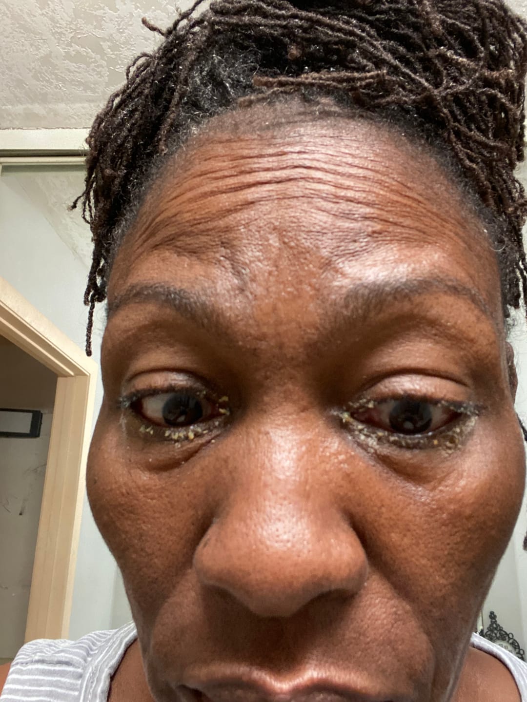 Customer photo review of Eye Wash