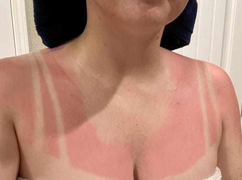 Customer photo review of SPF 50 Face Stick