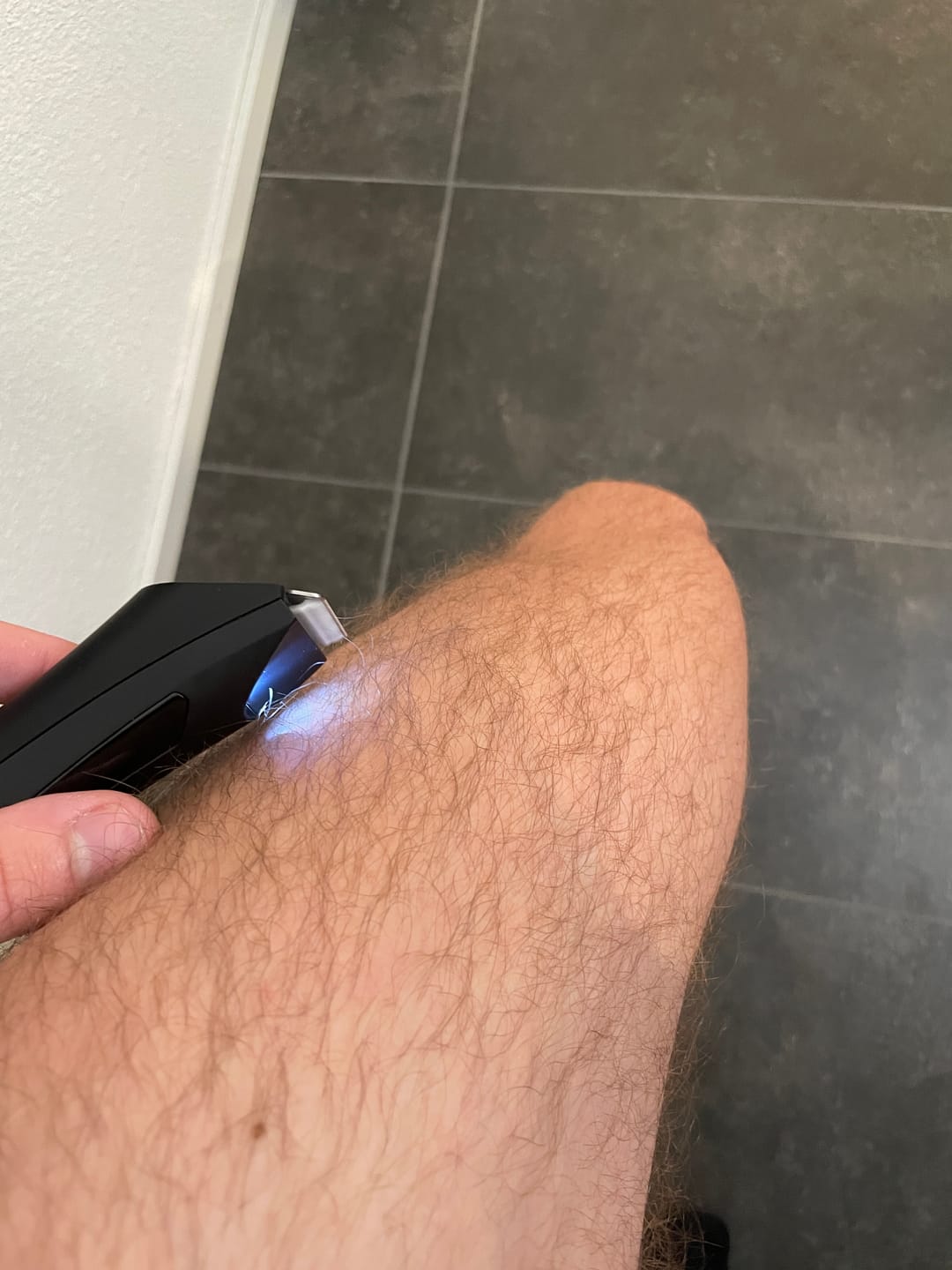 Customer photo review of EVERSHAVE Pro
