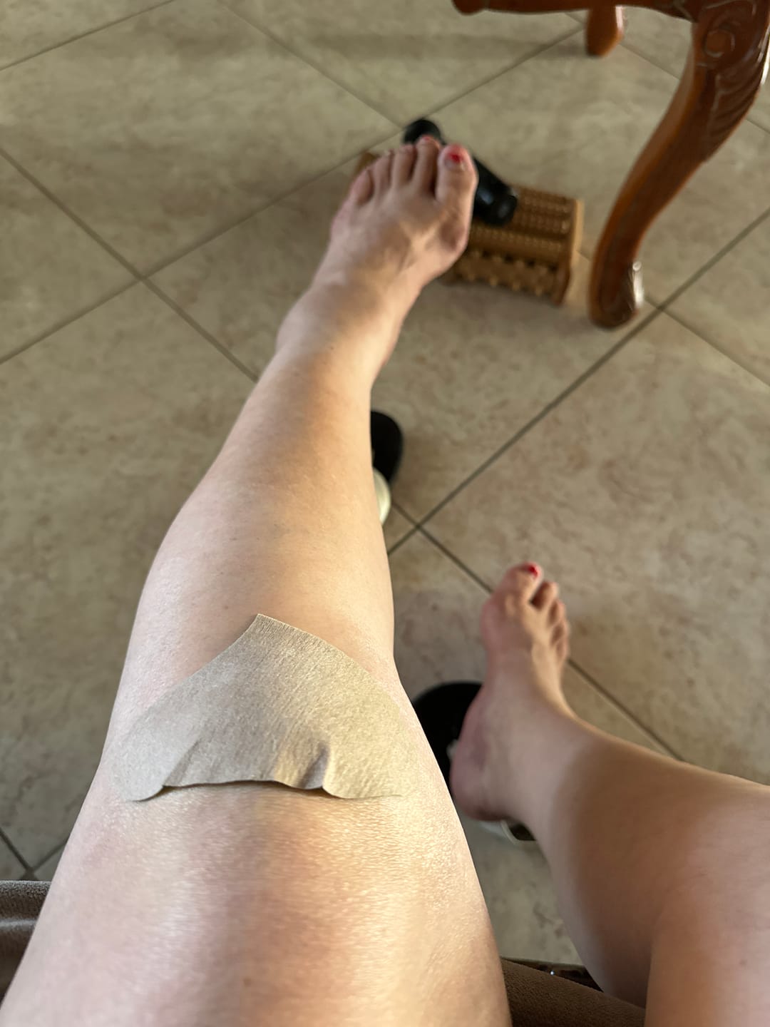 Customer photo review of Auxillium Knee Patch (fka Heaven Patch)