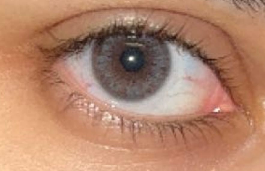 Customer photo review of Iris Blue