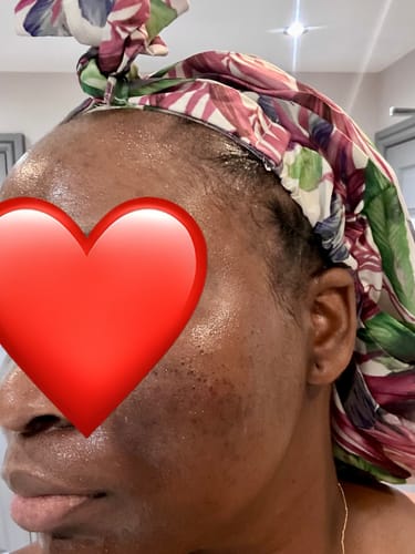 Customer photo review of Turmeric Glow Soap