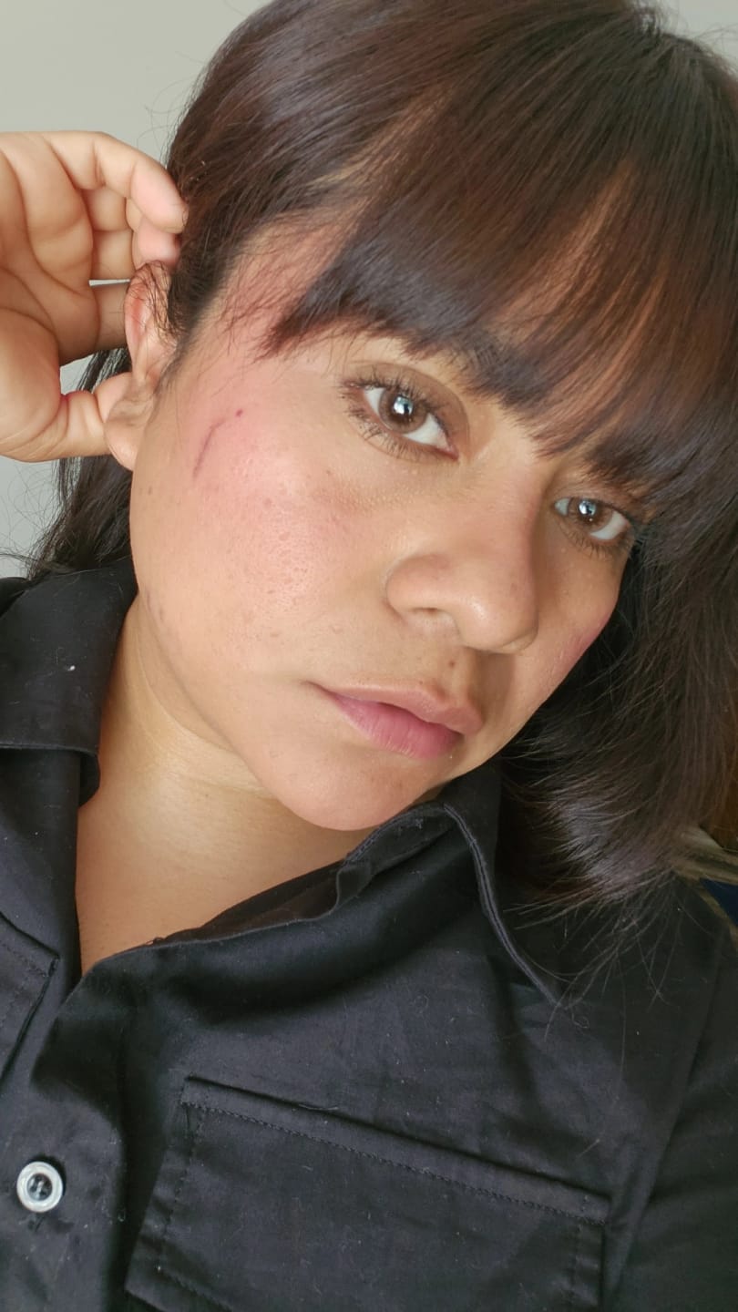 Customer photo review of Hinata Fresh Hazel Brown Prescription Colored Contact Lenses