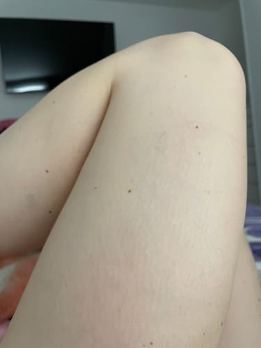 Customer photo review of GoLegs