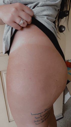 Customer photo review of Melanoboost Peptide Sun Tanning Oil