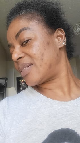 Customer photo review of Lighten Up Brightening Body Oil 125ml