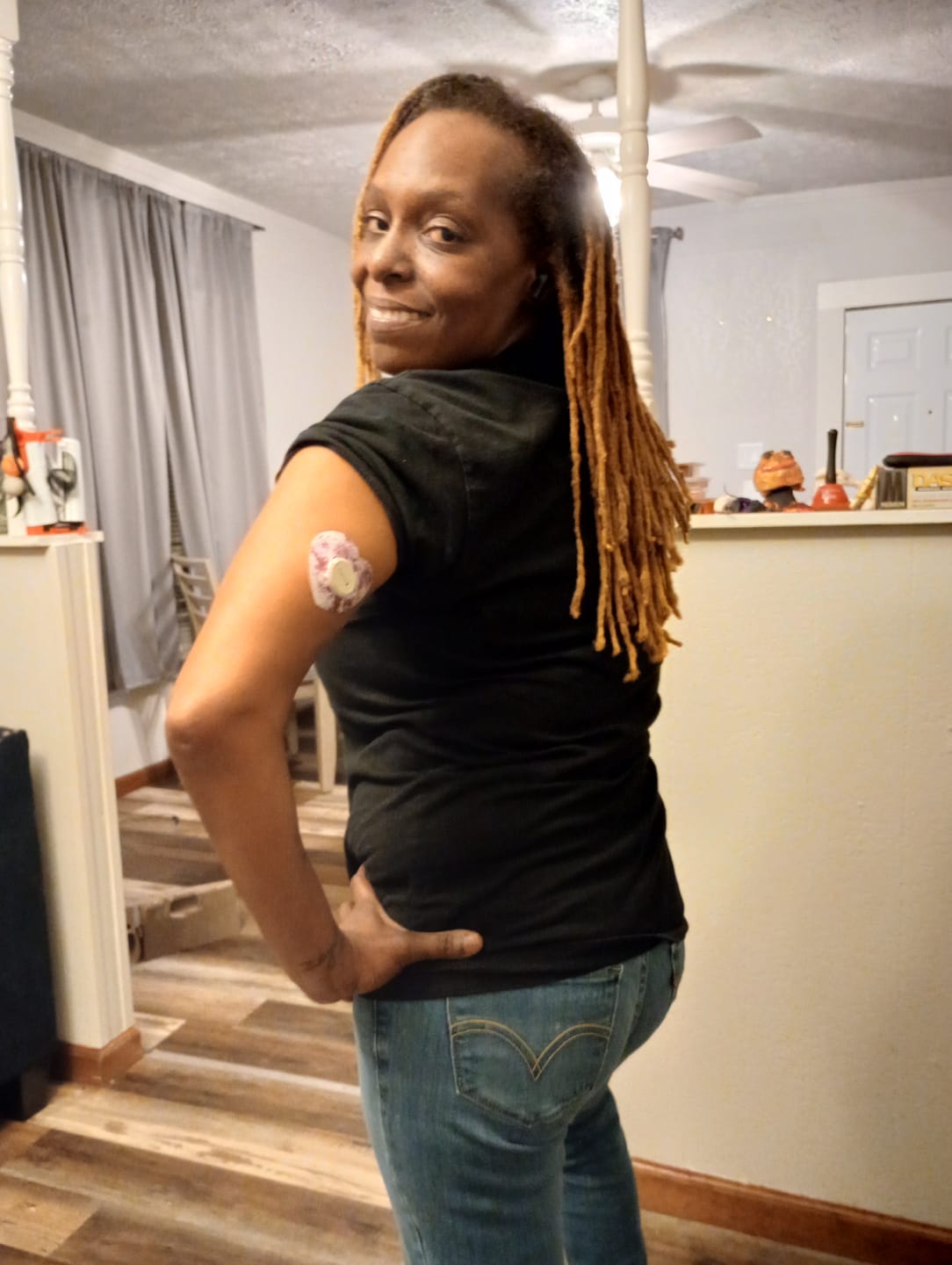 Customer photo review of Skin Grip Original - Dexcom G7 Adhesive Patches