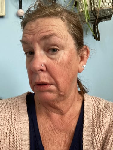 Customer photo review of Neptune Grass Fed Tallow & Honey Balm