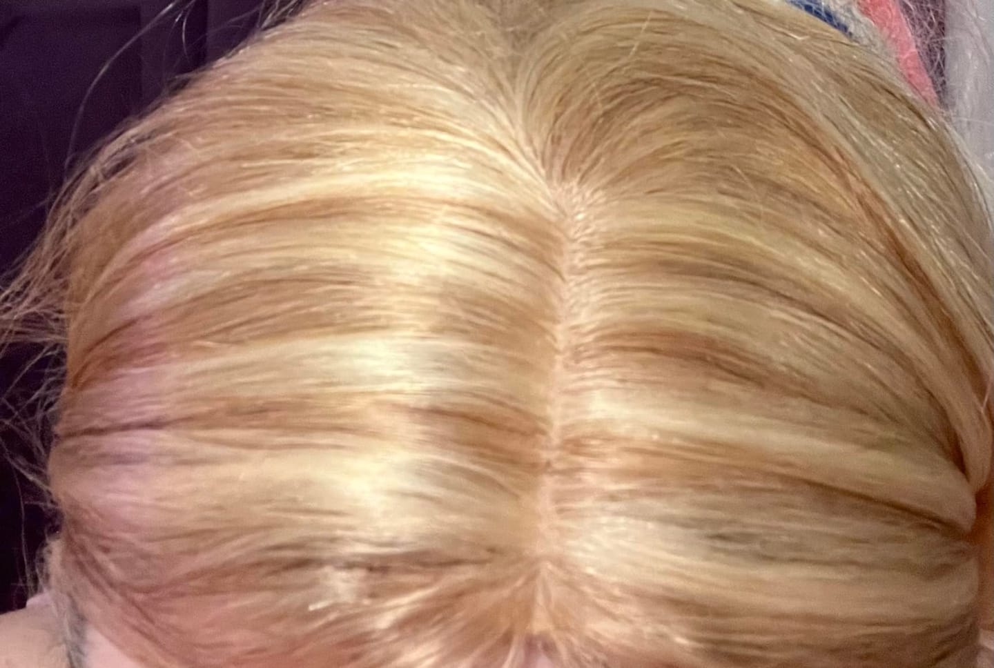Customer photo review of Mono Topper Human Hair Piece Toupee with Pink Gold Highlights & Clips #18/613