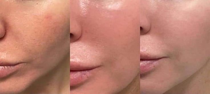Customer photo review of Ultra C: Vitamin C Serum