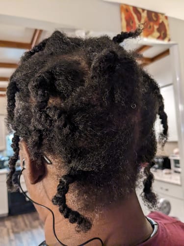 Customer photo review of Edge Serum