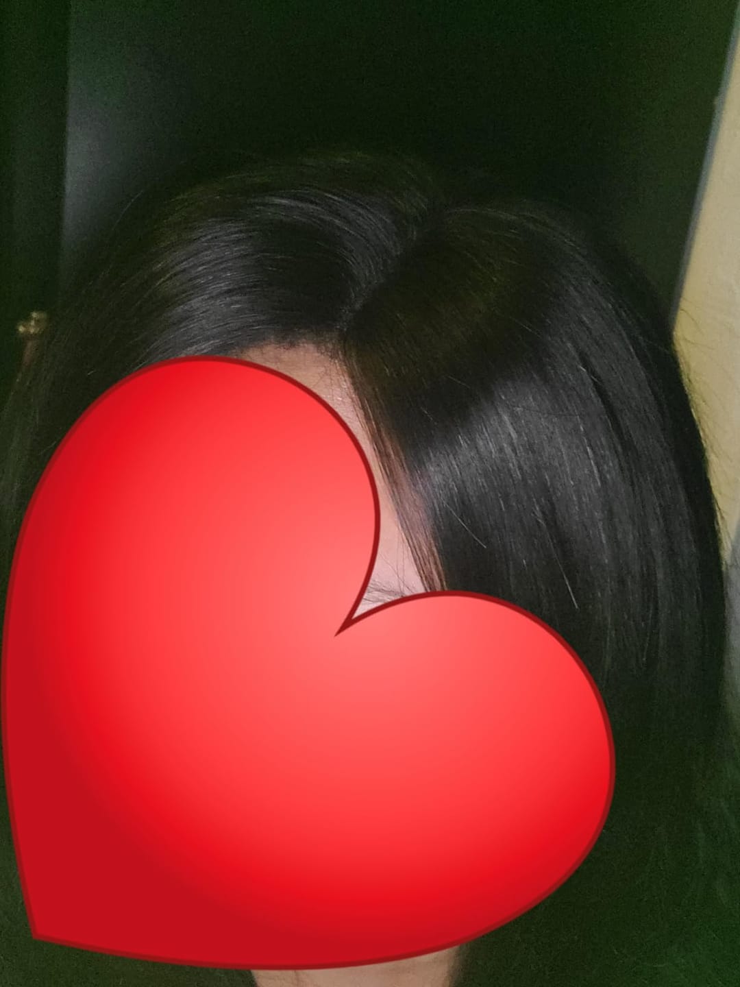 Customer photo review of Natural Black Human Hair Topper for Women with Thinning Hair #1B