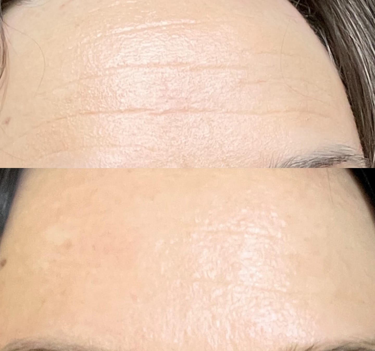 Customer photo review of Retinol 1% Serum  (Vitamin A) (30ml)