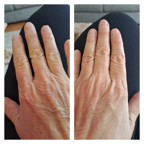 Customer photo review of Glow From Within Collagen - Bigger 500g Pack