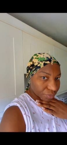 Customer photo review of Anti-Acne & Dark Spots African Soap