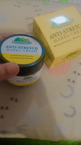 Customer photo review of Anti-Stretch Marks Cream – Formulated With Shea Butter, Coco Butter & Vitamin E, Prevent Scars & Stretch Marks With Intense Hydration & Smoothing