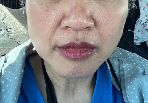 Customer photo review of Hydromer