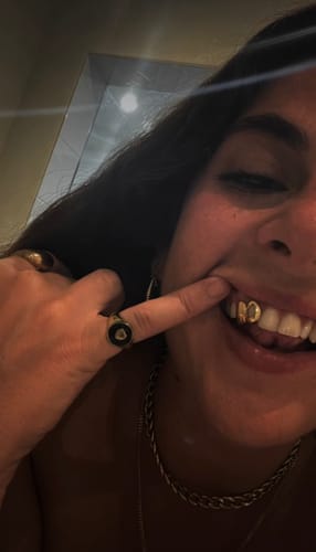 Customer photo review of PRISM (GOLD PLATED GRILLZ)