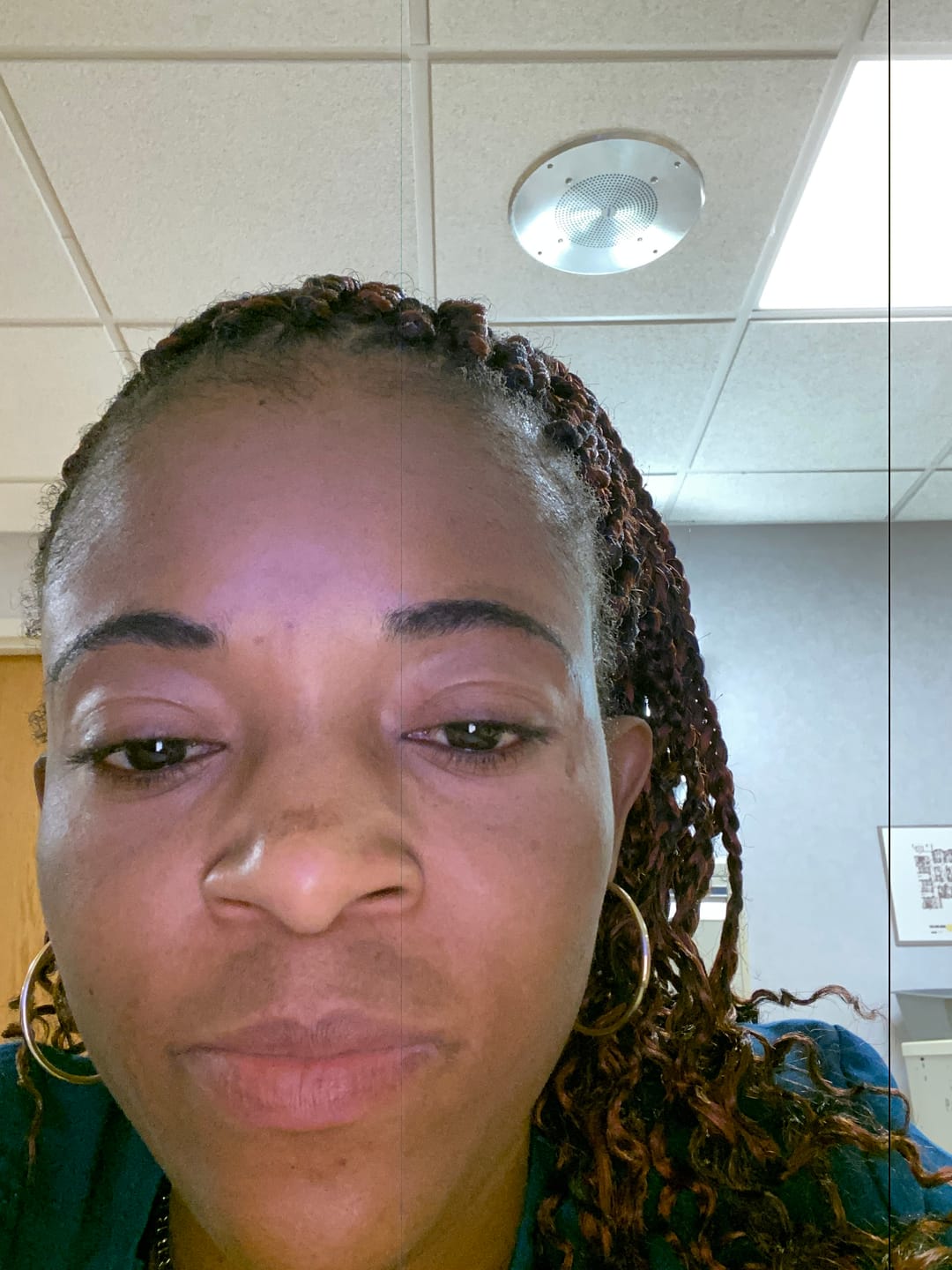 Customer photo review of Dark Spot Eraser Lotion