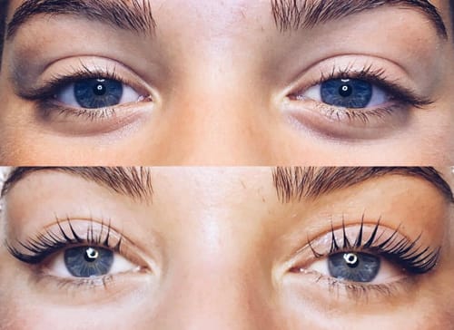 Customer photo review of COSTIQ® SERUM + CURL BUNDLE