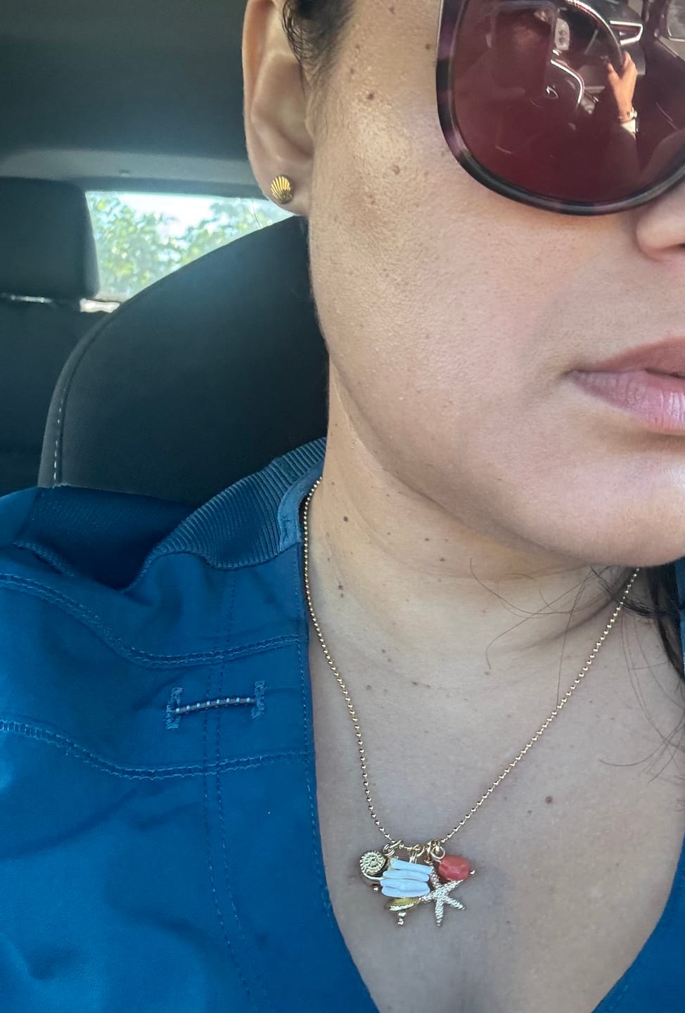 Customer photo review of Baylin Chain