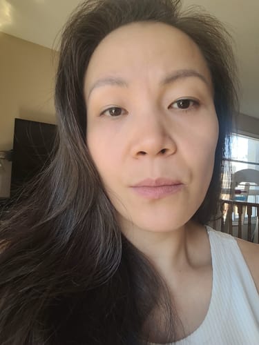 Customer photo review of Revision Skincare Teamine Eye Complex