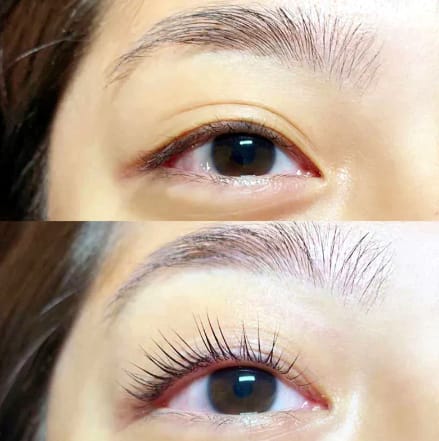 Customer photo review of COSTIQ® DAILY BUNDLE