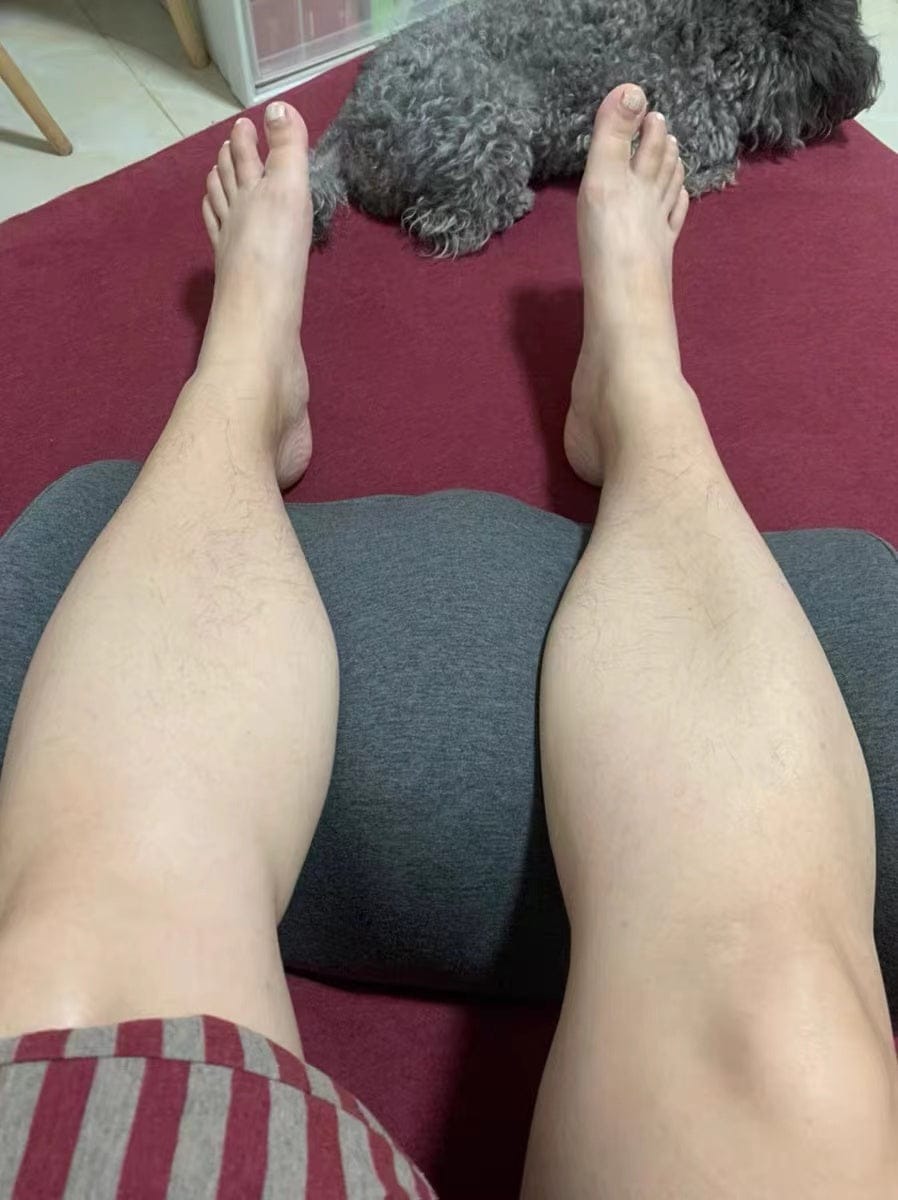 Customer photo review of Leg Spacer Pillow / Knee Pillow