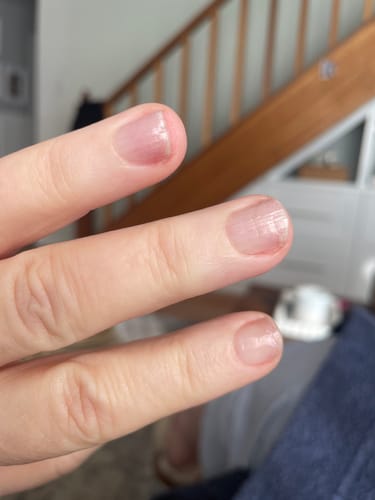 Customer photo review of Nail Guard | Clear Bandaid Nail Polish Wrap