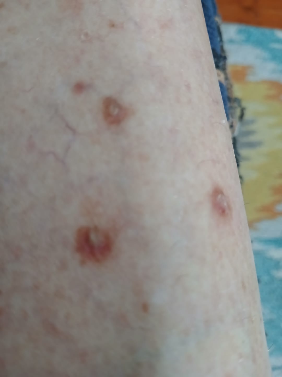 Customer photo review of DermaGen Propolis Balm - with Antiseptic, Anti-inflammatory, and Antioxidant Properties