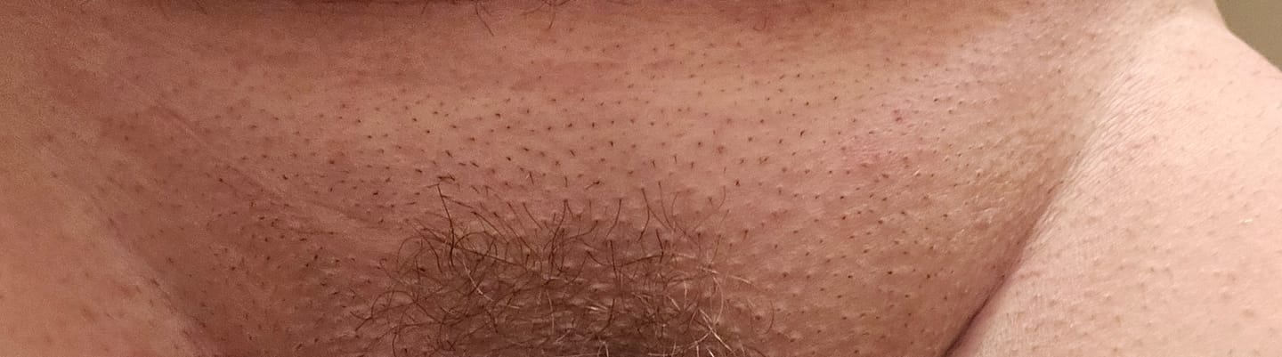 Customer photo review of INIA HAUTE Pro IPL Hair Removal Device