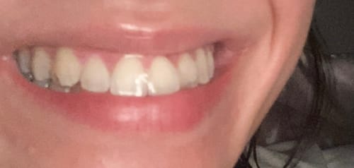 Customer photo review of REORDER-Upper Retainer