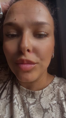 Customer photo review of Baume à lèvres éclaircissant rose permanent