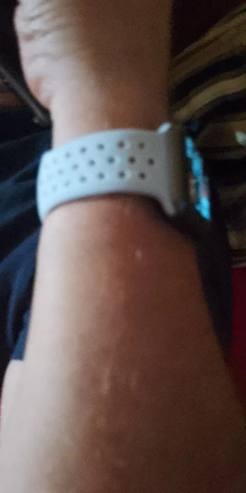 Customer photo review of Apple Watch Silicone Band - Soft Breathable Design
