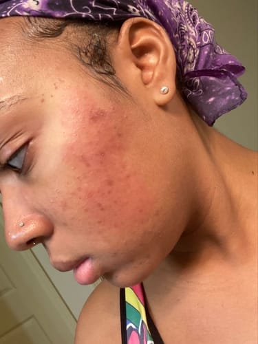 Customer photo review of LIMITED EDITION KIT Jolie’s Mini Full Body & Face Brightening Kit
