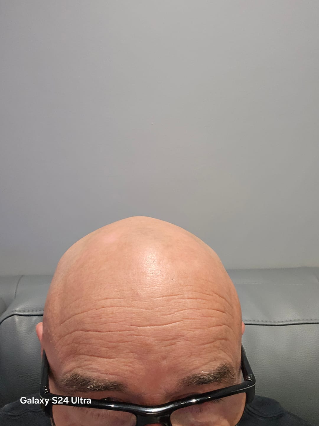 Customer photo review of Trimpod 3.0: The Ultimate Shaver for Bald Men
