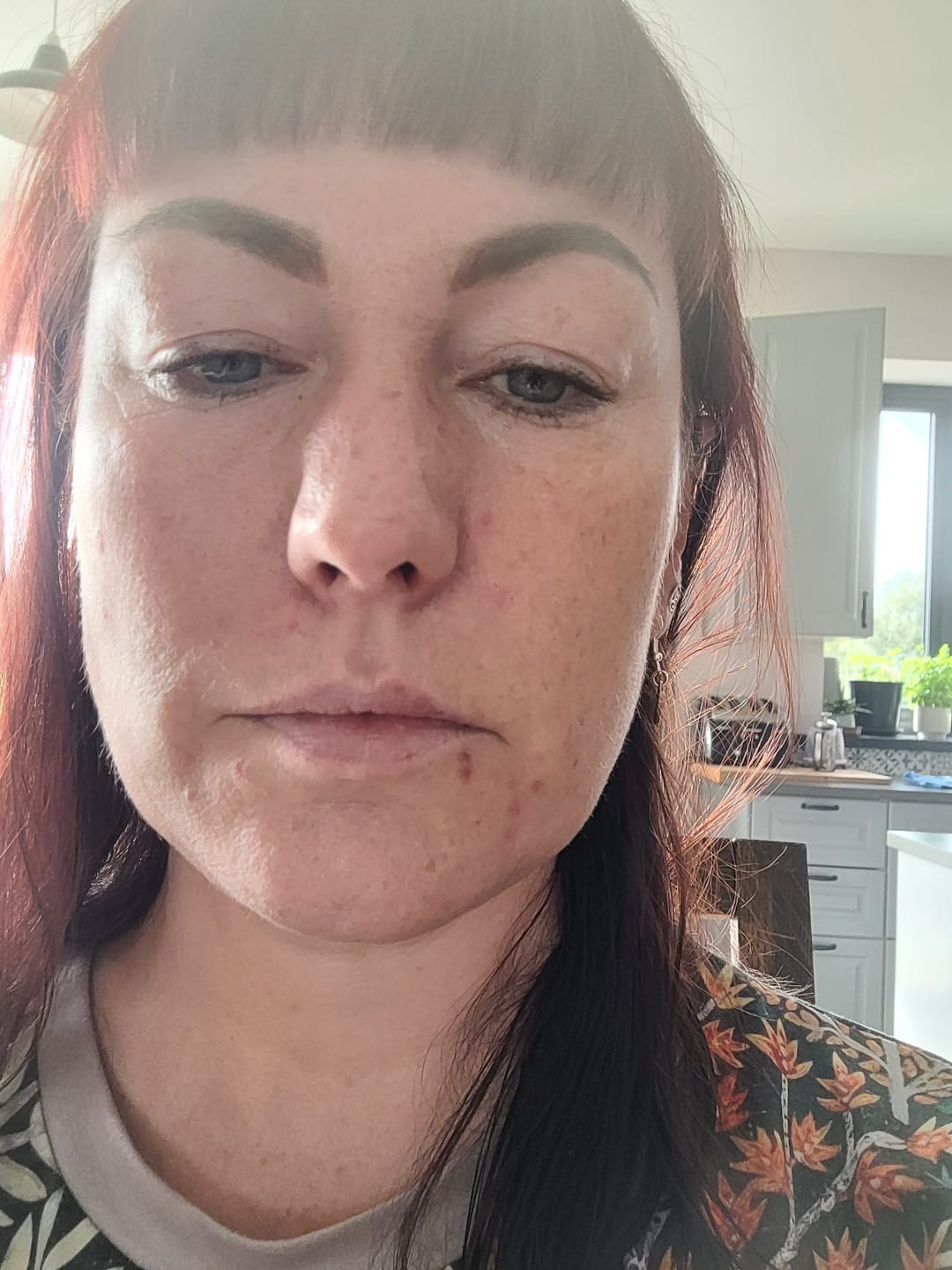 Customer photo review of Spot Soothe