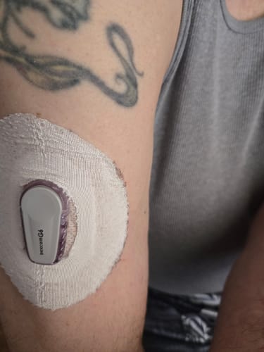 Customer photo review of Skin Grip Original - Dexcom G6 Patches